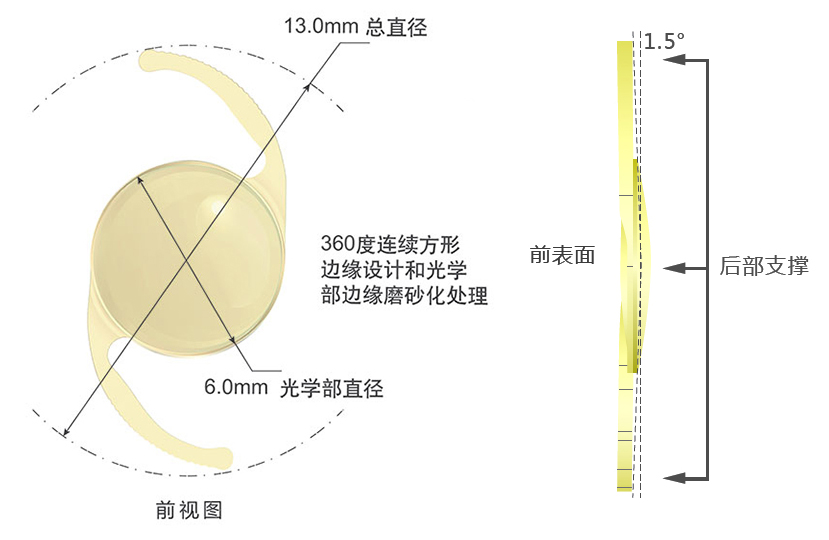 Proming普诺明肝素改性高次非球面人工晶状体AQ