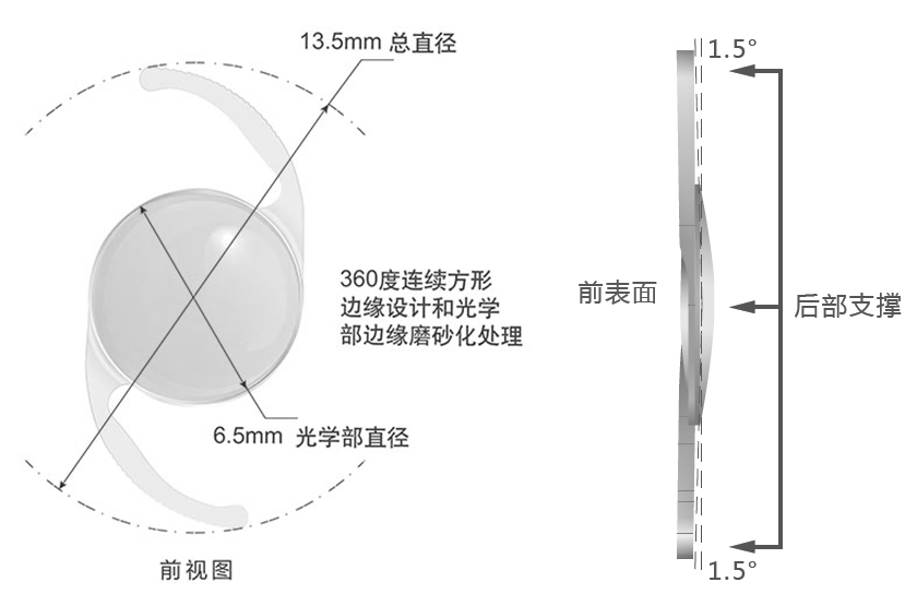Proming普诺明大光学区高次非球面人工晶状体ALD